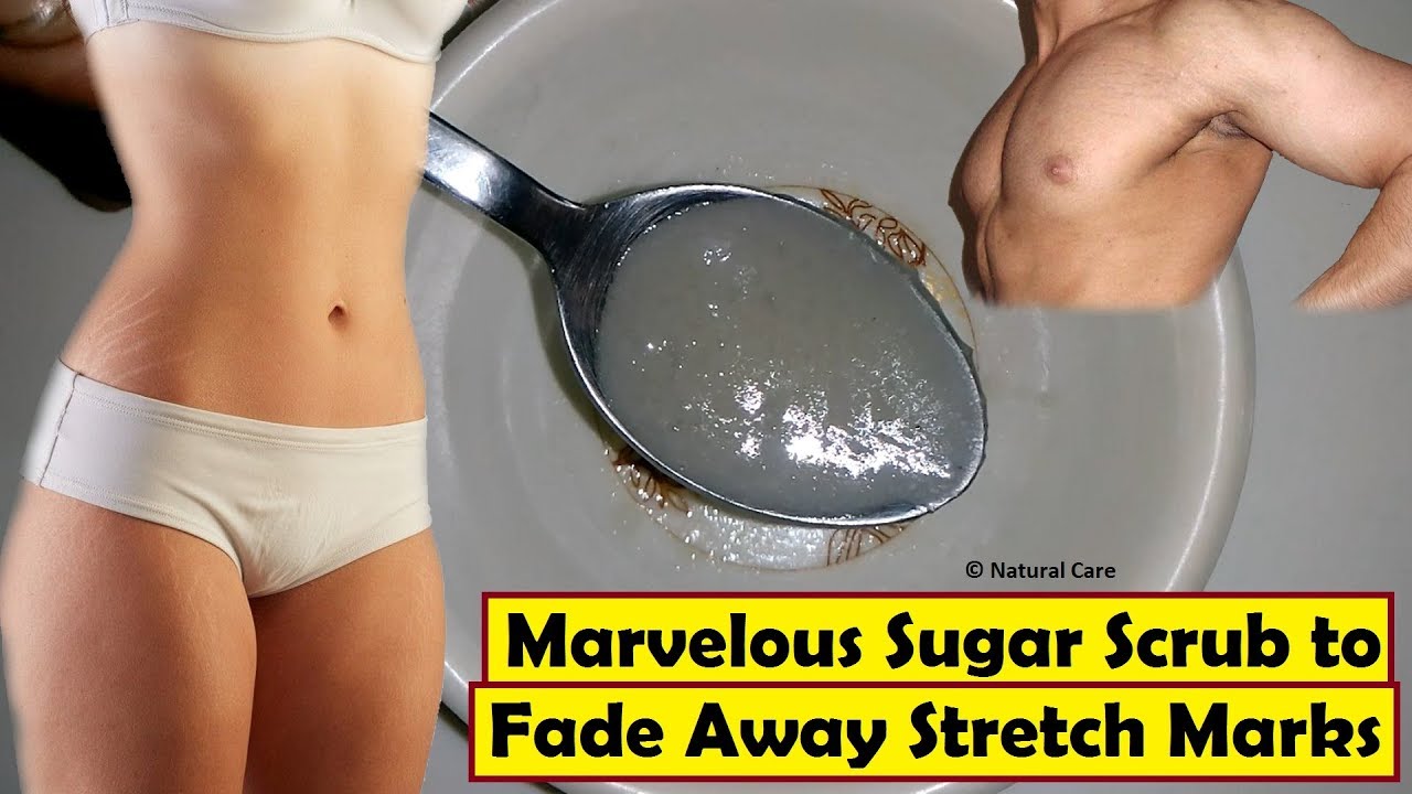 workout exercise ball Marvelous Sugar Scrub to Fade Away Stretch Marks