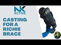 How to cast for a richie brace