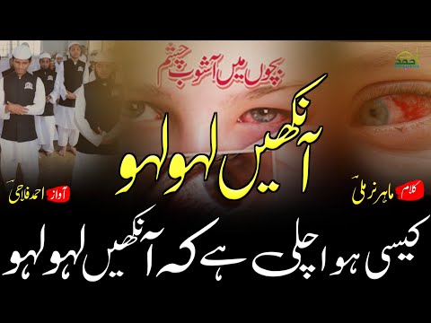 Kiski Ki Nazar Lagi hai - Nazam On Conjunctivitis - Qari Ahmed Falahi Mumbai