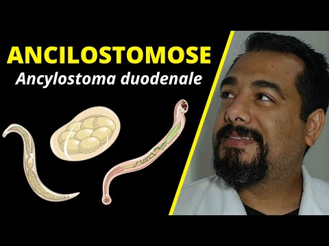 Vídeo: Ancilóstomo (ancilóstomo) - Sintomas, Como Se Livrar Da Ancilostomíase?