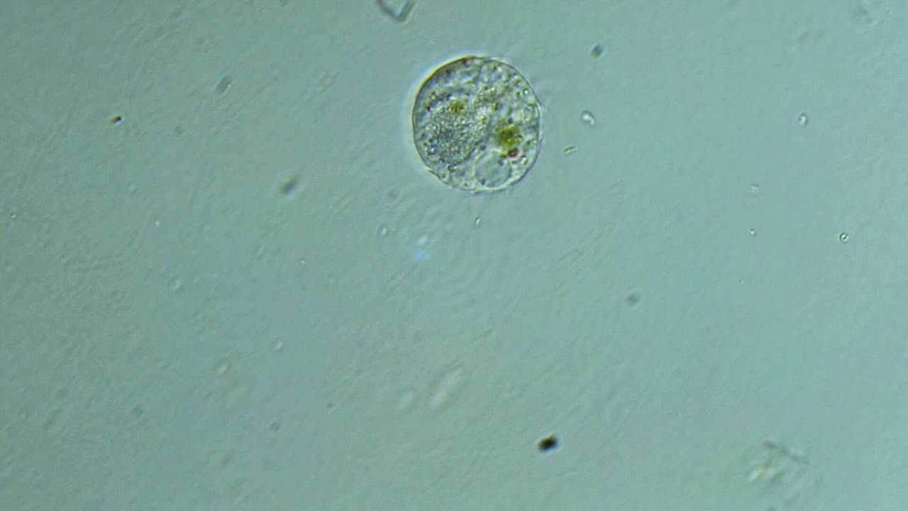 Ciliate: probably Halteria