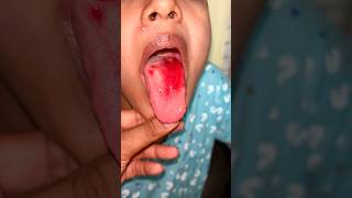 😭Blood Vomit During Pregnancy | Oral bleeding #pregnancyvlog #pregnant #pregnancyjourney