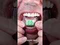 The Most Satisfying Chocolate and Candy ASMR Compilation 🍫🍬 #DoctorTristanPeh #Chocolate #Candy