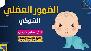 الضمور العضلي الشوكي  ||Spinal Muscular Atrophy || Expert Advice on Dealing with the Condition