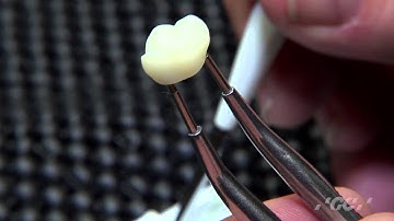 CeraSmart OptiGlaze Technique with Dan Boskocevic