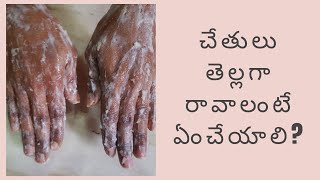 How to Get Fair Hands in Telugu | Hands Whitening at Home Telugu | చేతులు తెల్లగా రావాలంటే ఏంచేయాలి?