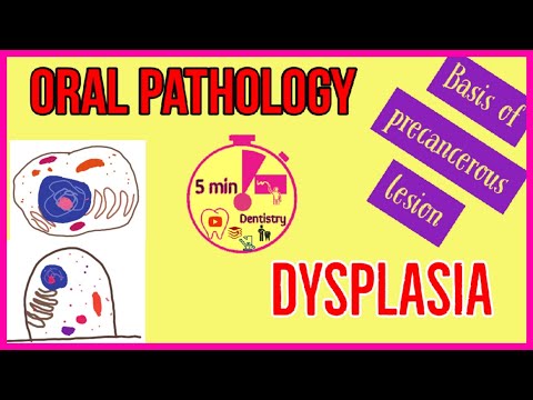 Video: Kas yra epitelio displazija?