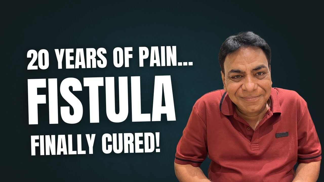 Mr. Vijay’s 20-Year Fistula Cured with DLPL Surgery by Dr. Ashwin Porwal