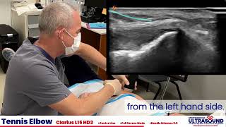 Tennis elbow injection demonstration Profile