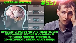 #537 Мозговые Импланты Уже Вживляют /  Украина И Россия На Пути К Миру