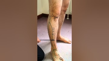 6. LL Sacral Plexus - Peroneal nerve