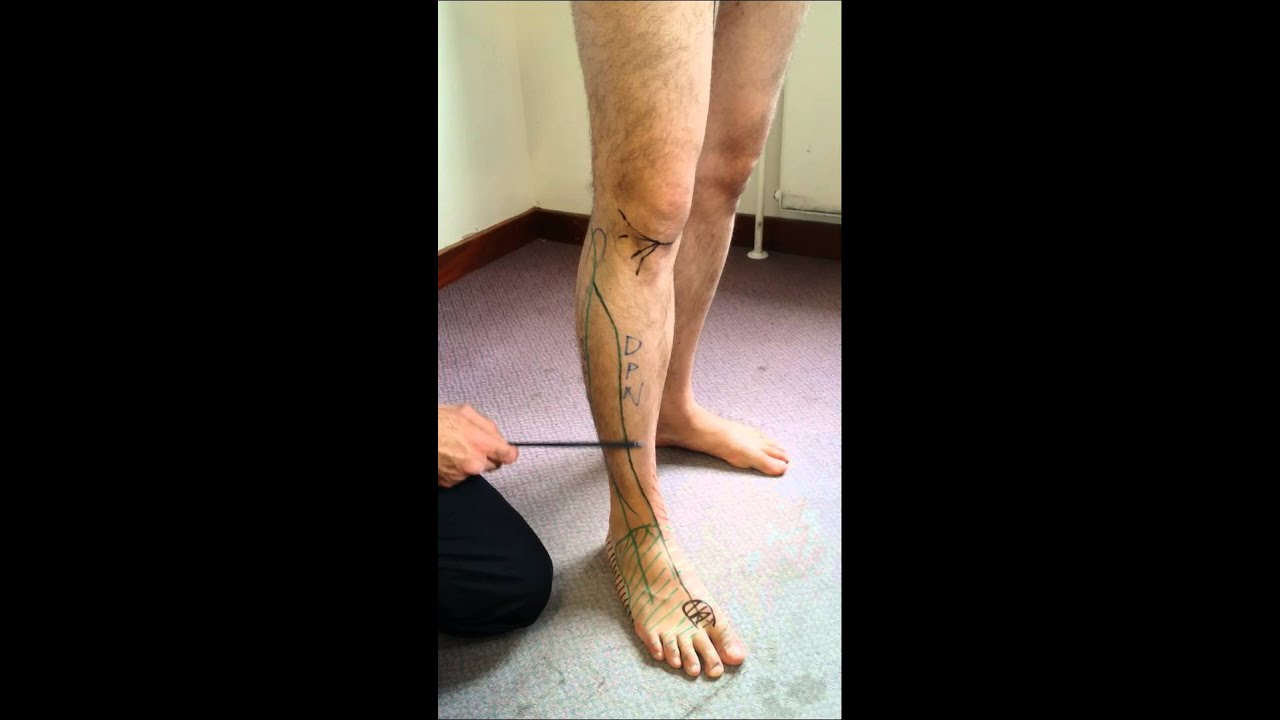 6. LL Sacral Plexus - Peroneal nerve