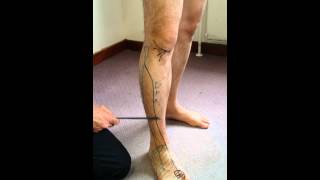 6. Ll Sacral Plexus - Peroneal Nerve