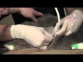 How to perform a thoracocentesis in a cat  vetgirl veterinary ces