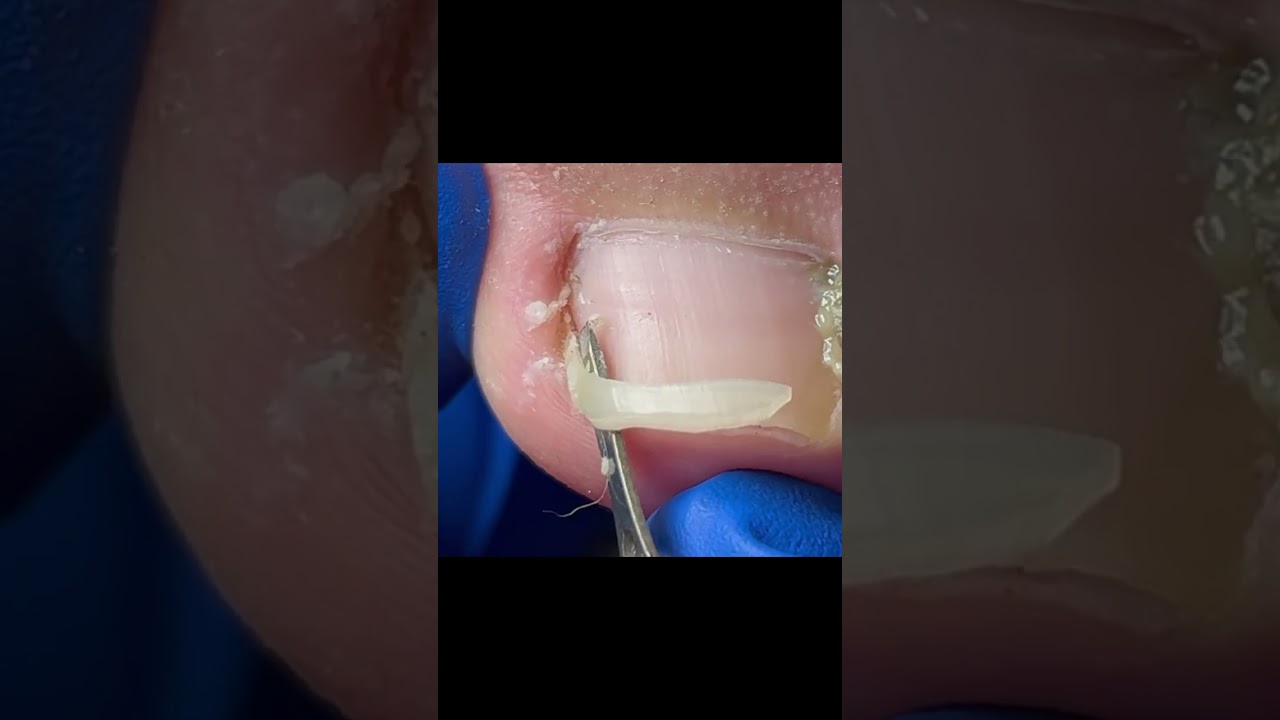 Удовлетворительное видео педикюра! # Педикюр