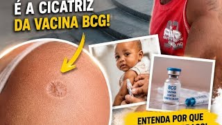 A Marca da Vacina BCG