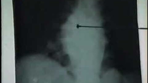 06 LaoCotSong[bacsihoasung.wordpress.com].wmv