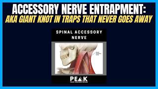 Watch Accessory The Trap video