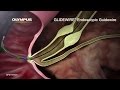GLIDEWIRE Endoscopic Hydrophilic Coated Guidewire Animation