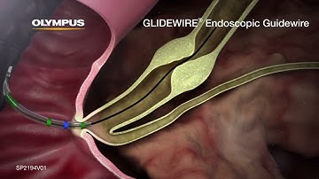 GLIDEWIRE Endoscopic Hydrophilic Coated Guidewire Animation