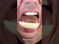 Most Satisfying Candy & Chocolate ASMR 🍫🍬 #DoctorTristanPeh #ASMR