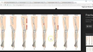 Musculoskeletal Surgery CPT screenshot 3