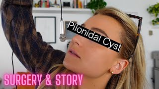 *MY PILONODAL CYST* Story & Surgery 😱 ✨