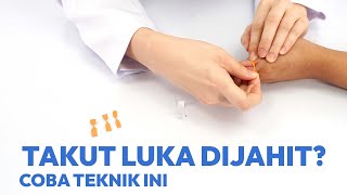 Teknik Plester Kupu-Kupu pada Luka Ringan