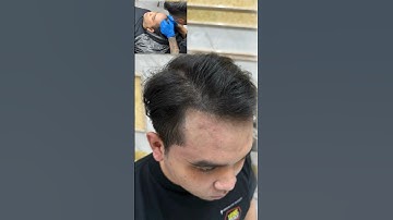 Tìm hiểu xăm tóc ở việt nam #xămtóc #scalp Bạn nam nào tóc hói chữ m như này xem nhé. #xămtóc