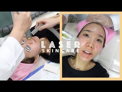 Laser Skincare Treatment in Korea: Acne Scars, Freckles, & Facial Hair Removal