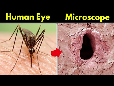 Things Under Microscope | Microscopic World |#shorts (Part - 4)