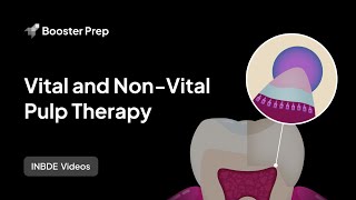 Endodontics | Vital and Non Vital Pulp Therapy | INBDE, NDEB, ADAT Endodontics | Vital and Non Vital Pulp Therapy | INBDE, NDEB, ADAT