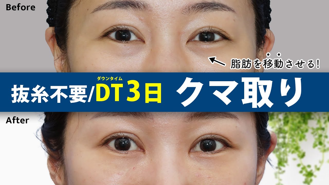 hq720.jpg?sqp=-