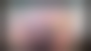 CataractCoach™ 1860: Canabrava double flanged technique for IOL fixation