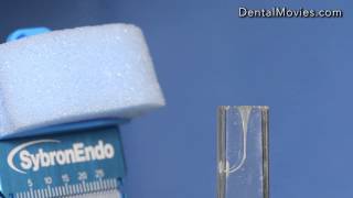 Powtórne Leczenie Endodontyczne Pierwszego Zęba Trzonowego Żuchwy.