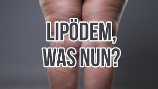 Diagnose Lipödem: Was jetzt??