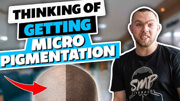 Before You Get Scalp Micro Pigmentation 😬 Watch This!!