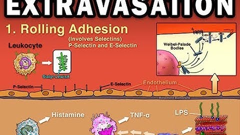 EXTRAVASATION