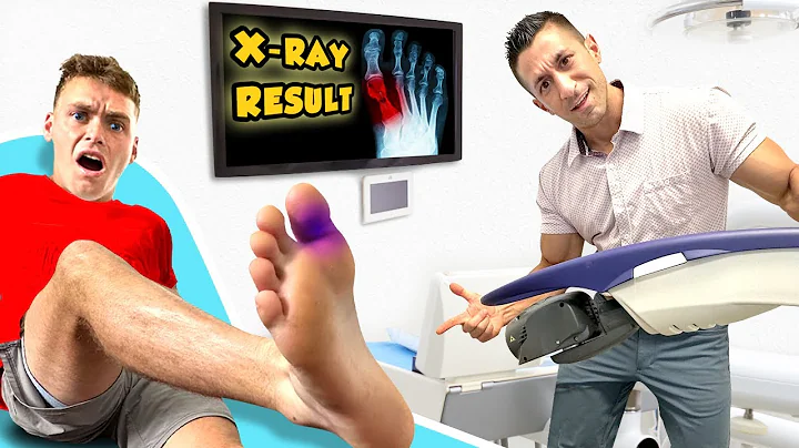 I BROKE MY TOE!