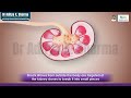 Shockwave Lithotripsy for Kidney | Dr. Aditya K. Sharma