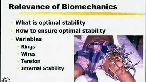 Biomechanics of Ilizarov Fixator