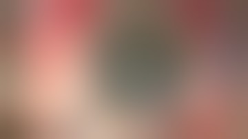 Practical pearls for Phaco in  Soft Cataract Dr Zain Khatib