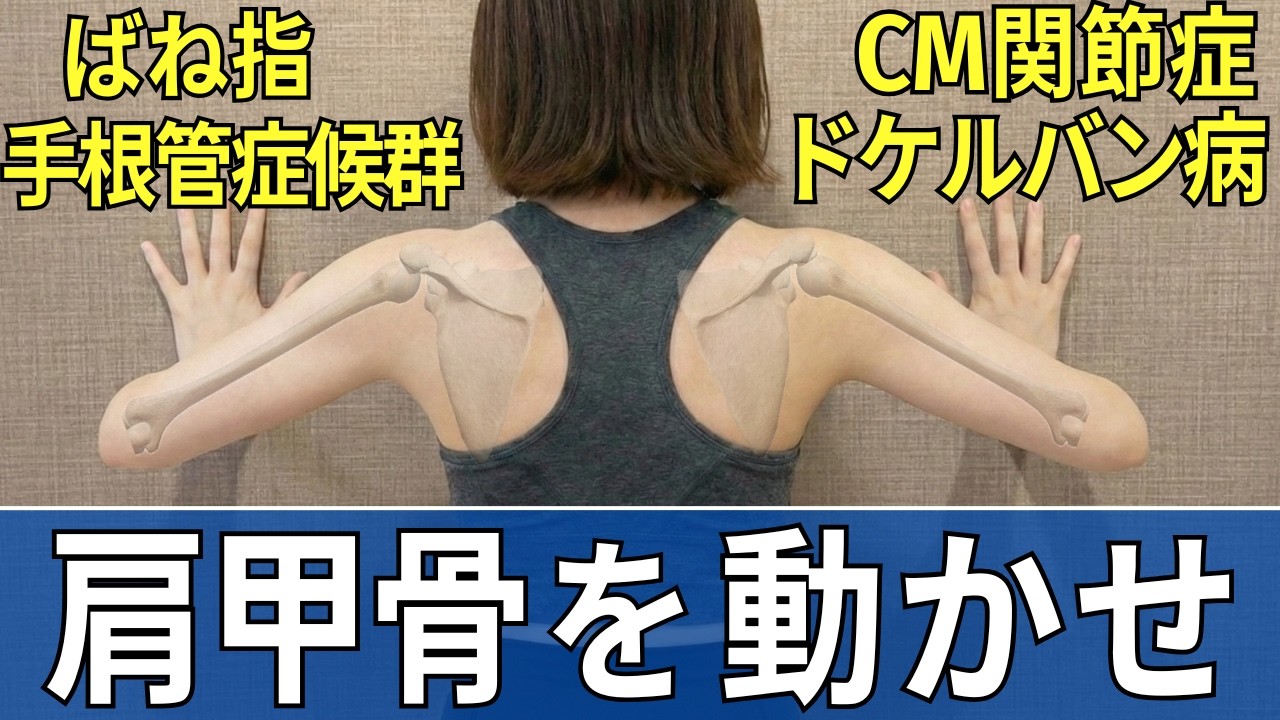Pain in Carpal Tunnel Syndrome, Cervix Joint Arthropathy, De