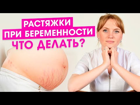 Как бороться с растяжками в домашних условиях во время беременности