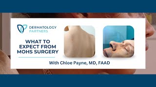 What is Mohs Surgery? What to Expect with Chloe Payne, MD, FAAD