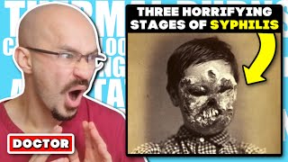 DOCTOR Reacts to The Three Horrifying Stages of Syphilis