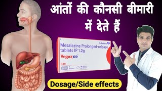 इस Tablet से Ibd को Control करे Mesalamine Tablet Mesalamine Prolonged Release Tablets In Hindi