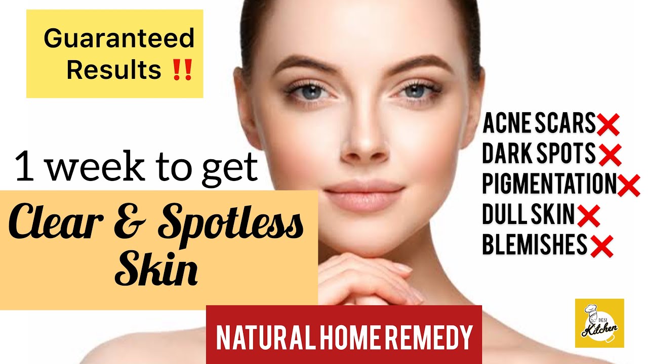 how to get clear skin in 1 week | Home remedy | Get rid of acne scar ...