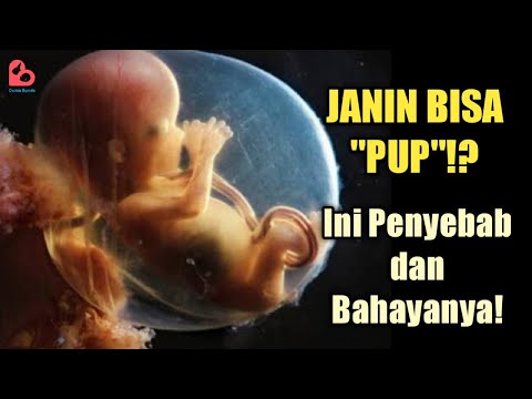 Video: Apakah janin buang air besar di dalam rahim?