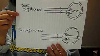 Physics Project on the Eye